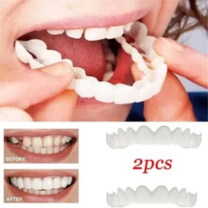 Title: Snap-On Cosmetic Teeth Cover Set | Upper & Lower Smile Covers UK